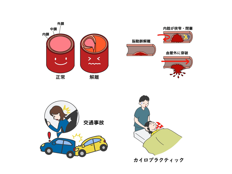 頭痛外来イメージ8