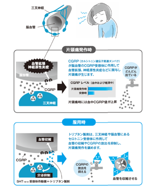頭痛外来イメージ22
